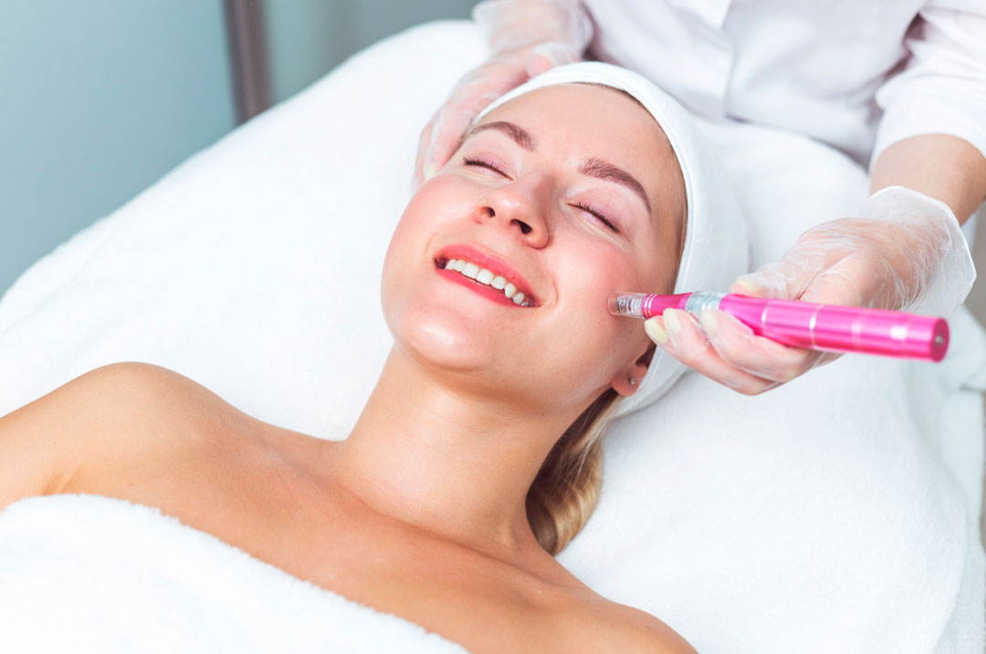 microneedling santiago